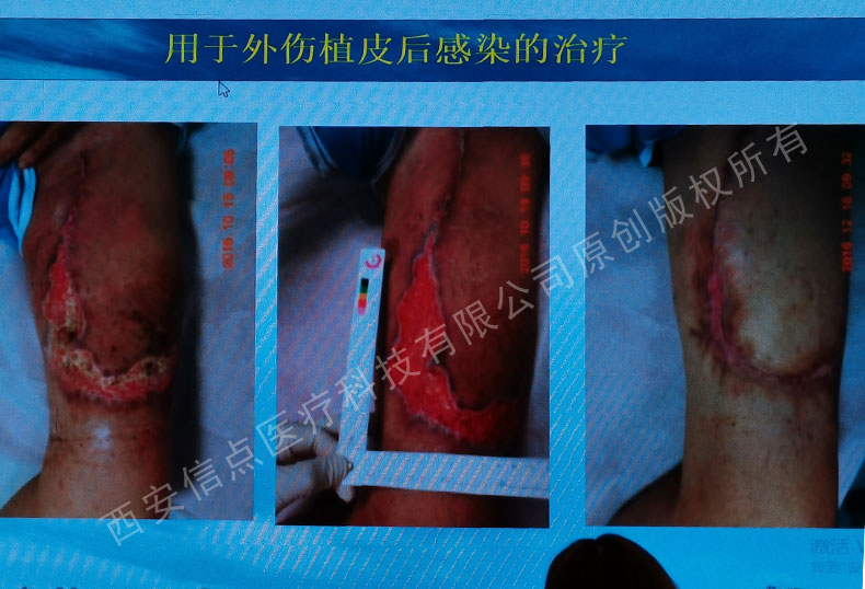 國標起草人李新武老師進行陜西省消毒產(chǎn)品衛(wèi)生監(jiān)督骨干培訓(xùn) 信點醫(yī)療技術(shù)骨干參加(圖16)