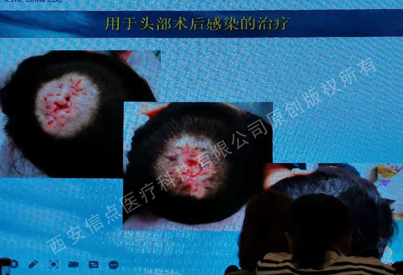 國標起草人李新武老師進行陜西省消毒產(chǎn)品衛(wèi)生監(jiān)督骨干培訓(xùn) 信點醫(yī)療技術(shù)骨干參加(圖17)