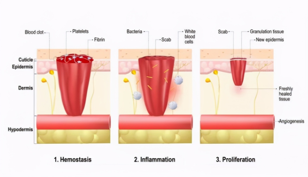 新型殺菌成分次氯酸，你了解多少？