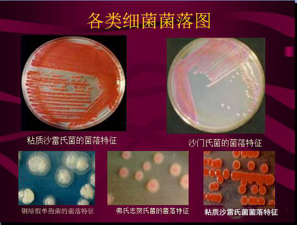 常見微生物菌落形態(tài)及消毒滅菌方式(圖4)