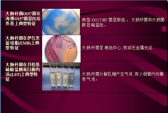 常見微生物菌落形態(tài)及消毒滅菌方式(圖7)