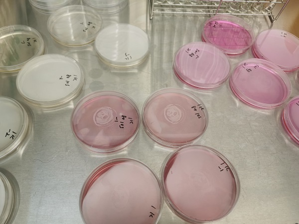 吃飯前熱水燙餐具真能殺菌嗎？實(shí)驗(yàn)真相來啦(圖7)