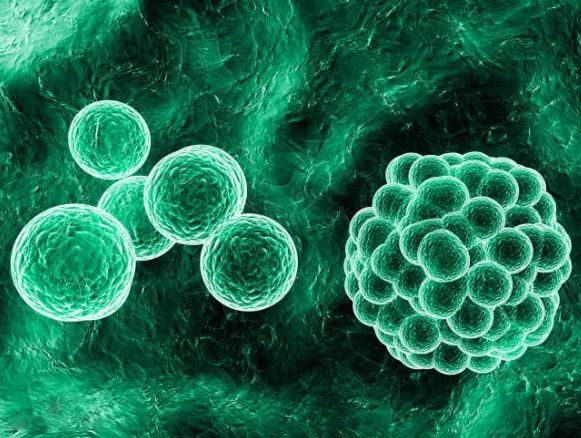 信點(diǎn)醫(yī)療告訴你，消毒與滅菌、抗菌、抑菌有何區(qū)別？(圖2)