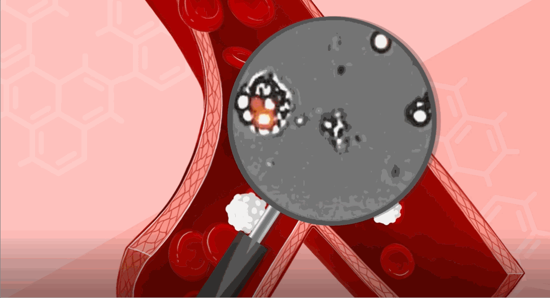 人體內(nèi)的次氯酸消毒液工廠——中性粒細(xì)胞(圖4)